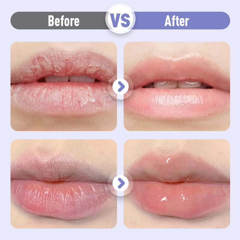 👑Hydraterend serum dat de lippen voller maakt en rimpels bestrijdt💋