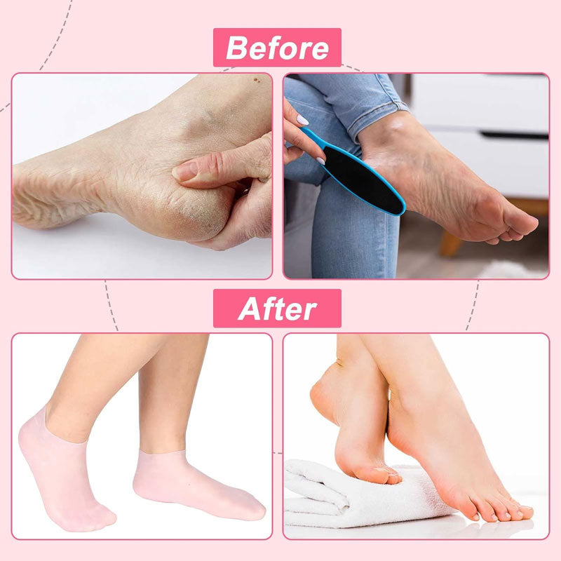 💥Köp 2 få 1 gratis-Exfolierande silikonstrandstrumpor - Föryngra dina fötter! 👣💕