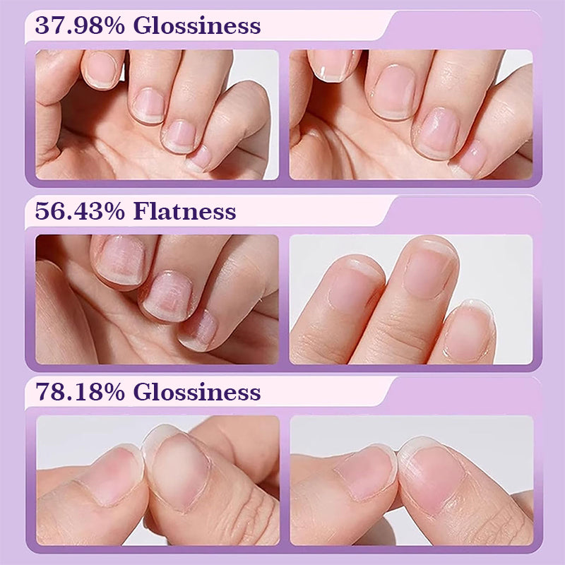 Nagelverzorgingsessence Pen